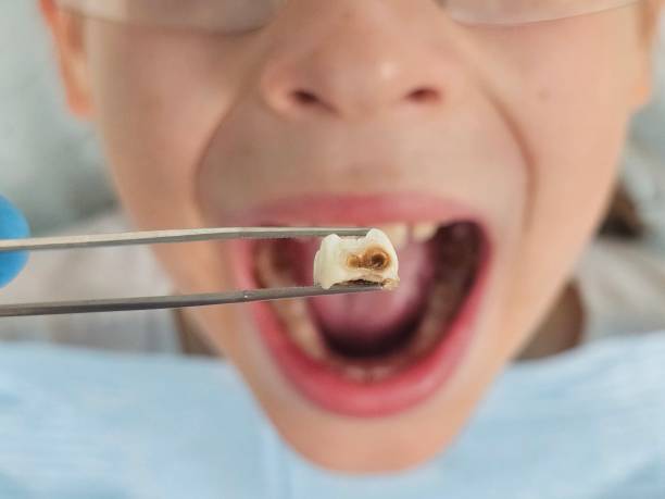 Best Emergency Tooth Extraction  in Trevose, PA